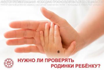 родинки у детей